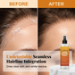 🥳PROMOÇÃO 2026🥳💞MAIS DE 50 MIL VENDIDOS!🧡✨Spray Fixador para Ajuste de Renda